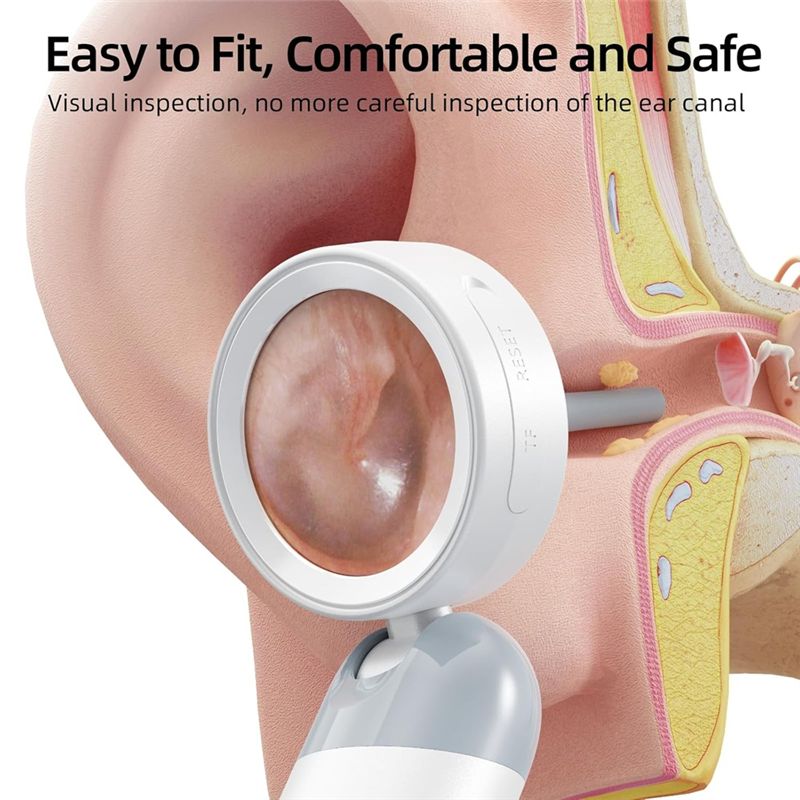 LXYB18B Wireless Ear Otoscope  - Home Security And Cameras recension och pris