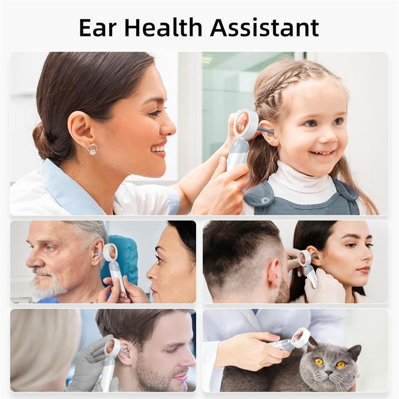 LXYB18B Wireless Ear Otoscope  - Home Security And Cameras recension och pris